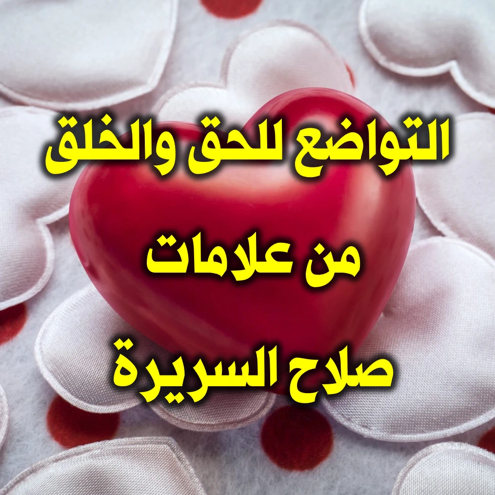 التواضع للحق والخلق من علامات صلاح السريرة