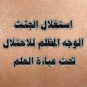 استغلال الجثث الوجه المظلم للاحتلال تحت عباءة العلم 300x300